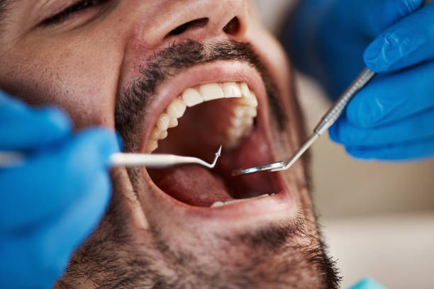 Best Knocked-Out Tooth Emergency  in Sunrise, FL