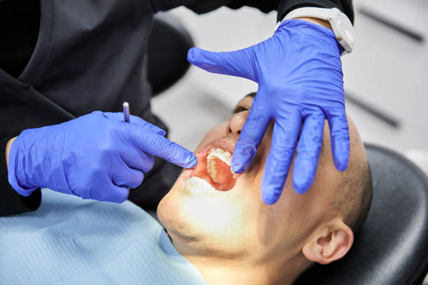 Best Knocked-Out Tooth Emergency  in Sunrise, FL